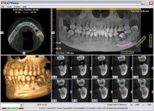 Cbct xray analysis